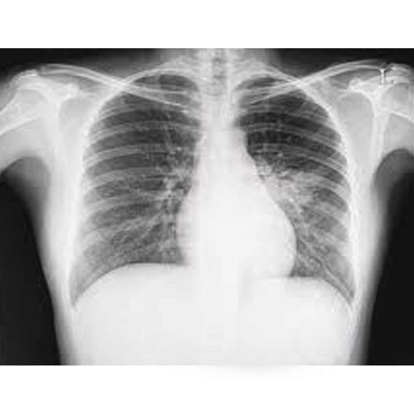digital-xray