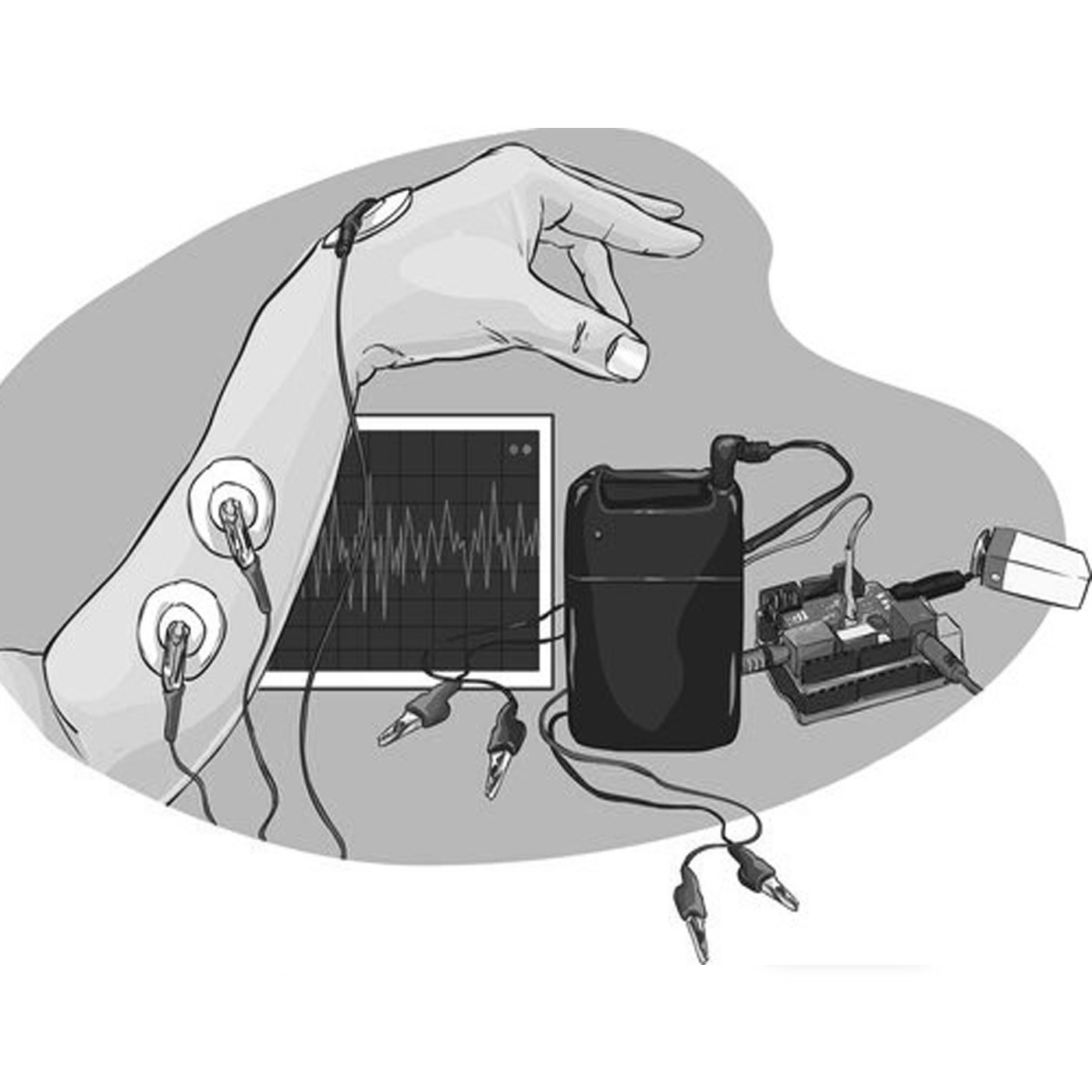 emg-electromyography-in-hindi