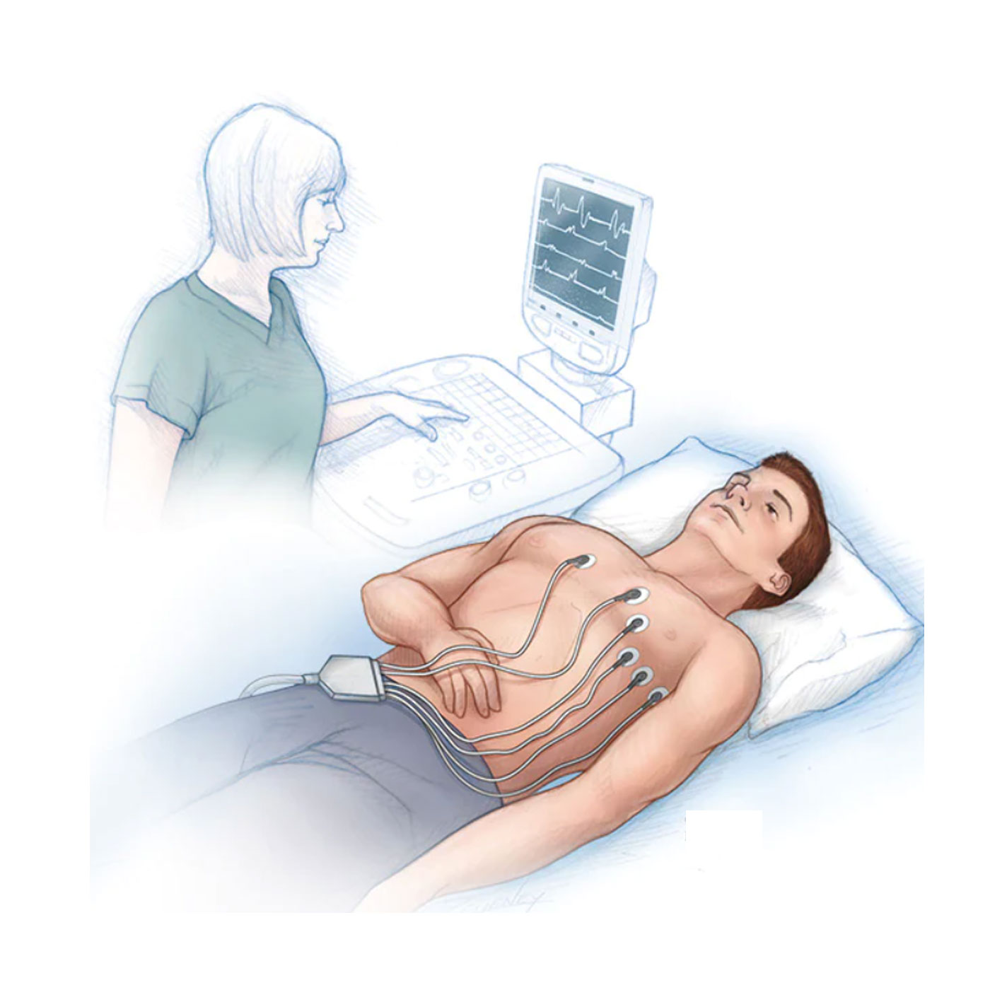 ecg
